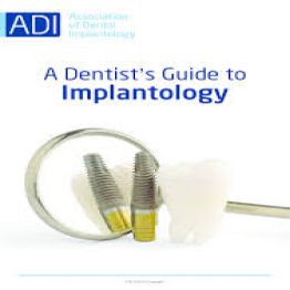 a-dentists-guide-to-implantology