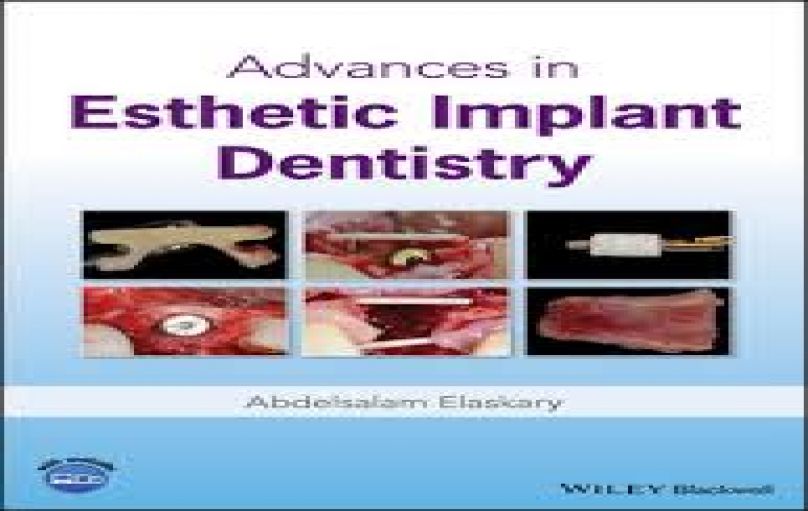 Advances in Esthetic Implant Dentistry-download