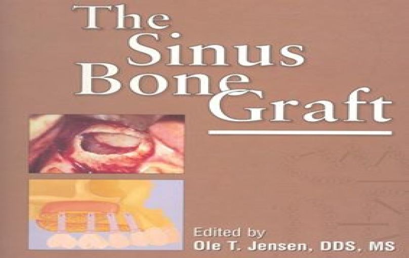 The Sinus Bone Graft - Quintessence Pub; 1st edition (1998)-download