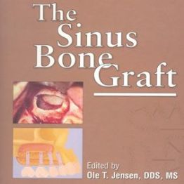 The Sinus Bone Graft - Quintessence Pub; 1st edition (1998)