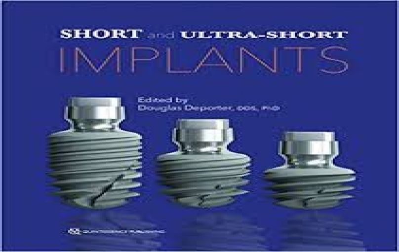 Short and Ultra-Short Implants-download