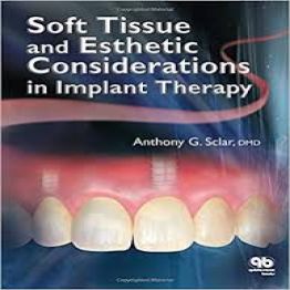 Soft Tissue and esthetic considerations in implant therapy
