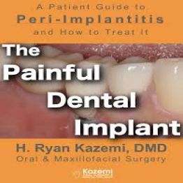 The Painful Dental Implant Patient%u2019s Guide to Peri-Implantitis