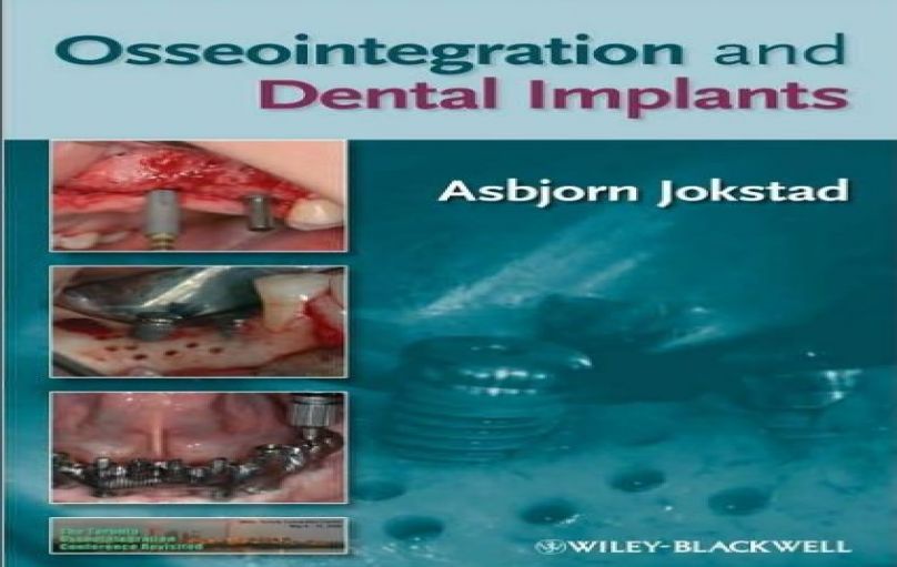 Osseointegration and Dental Implants-1st edition (2009)-download