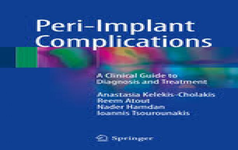Peri-Implant Complications-2018-download