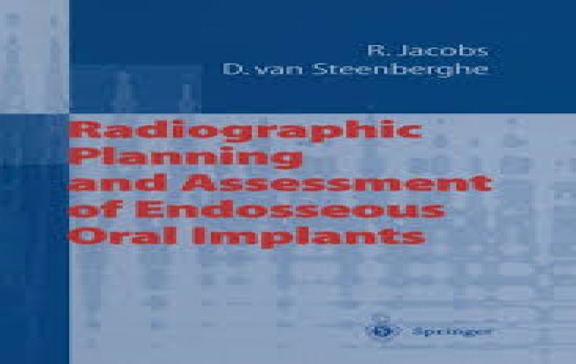 Radiographic Planning and Assessment of Endosseous Oral Implants-download