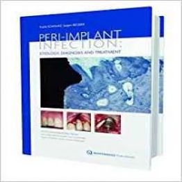 Peri-implant Infection Etiology, Diagnosis and Treatment