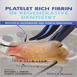 Platelet Rich Fibrin in Regenerative Dentistry