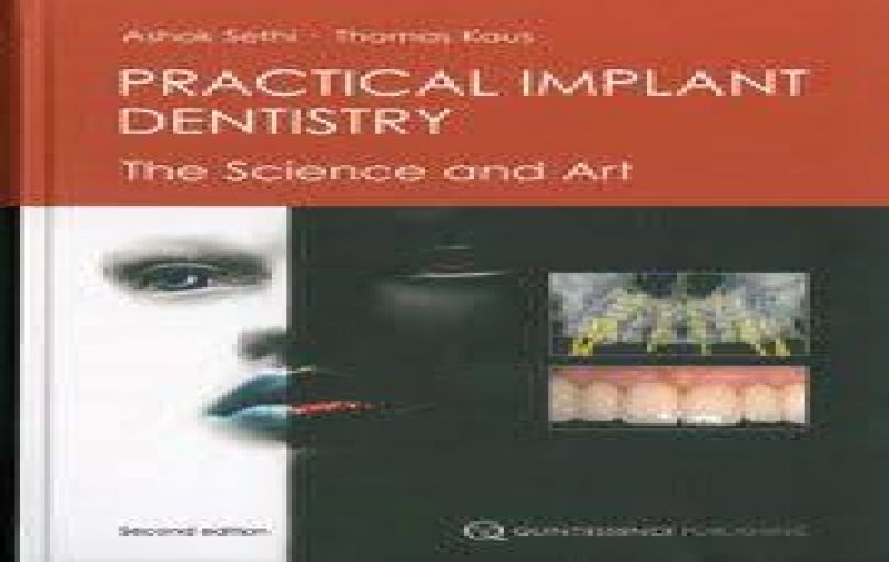 Practical Implant Dentistry The Science and Art-2nd-Edition-download