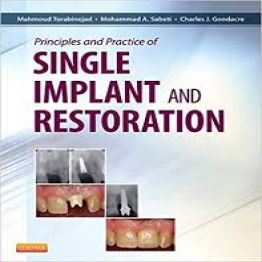 Principles and Practice of Single Implant and Restoration-1 edition (2013)