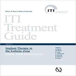 ITI Treatment Guide Vol(1- 9)
