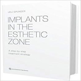 Implants In The Esthetic Zone - A Step-By-Step Treatment Strategy (2016)