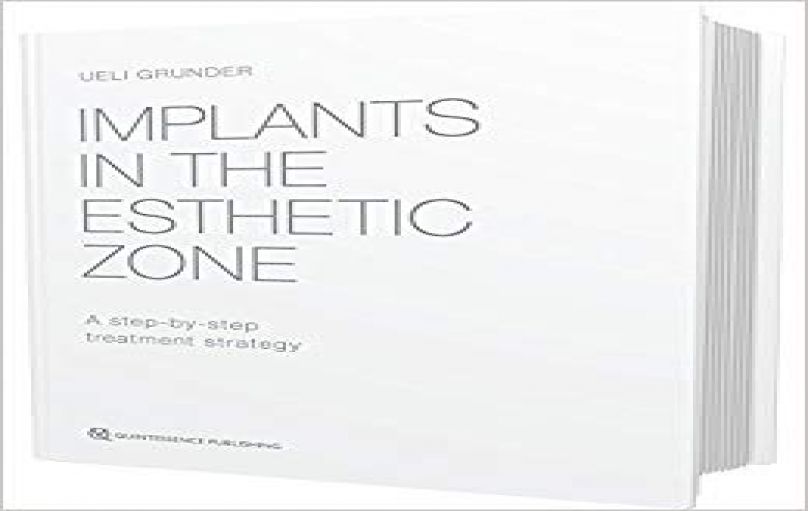 Implants In The Esthetic Zone - A Step-By-Step Treatment Strategy (2016)-download