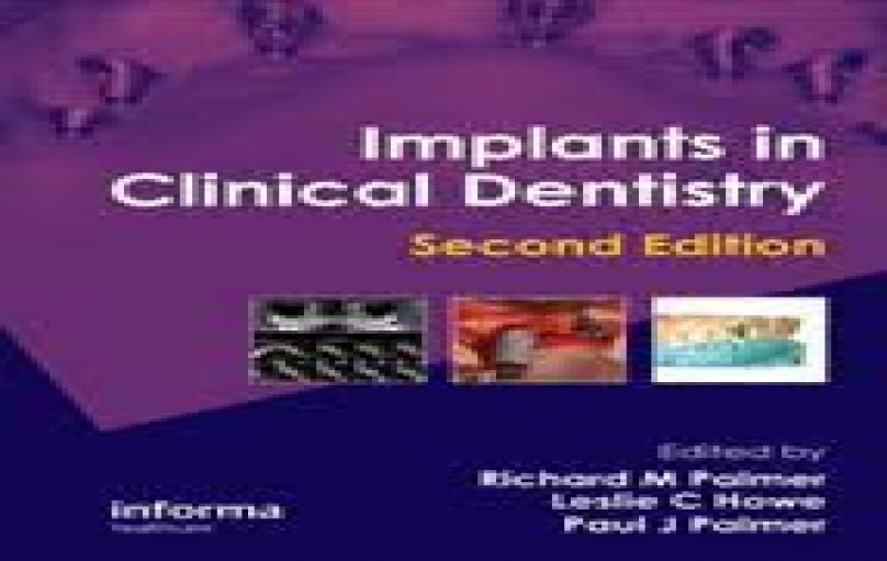 Implants in Clinical Dentistry - Informa Healthcare; 2 edition (2012)-download