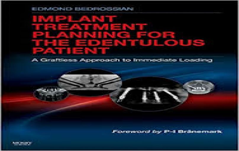 Implant Treatment Planning for the Edentulous Patient-download