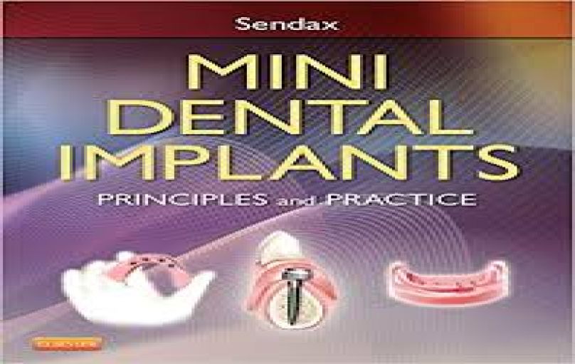Mini Dental Implants- Principles and Practice ( 2012)-download