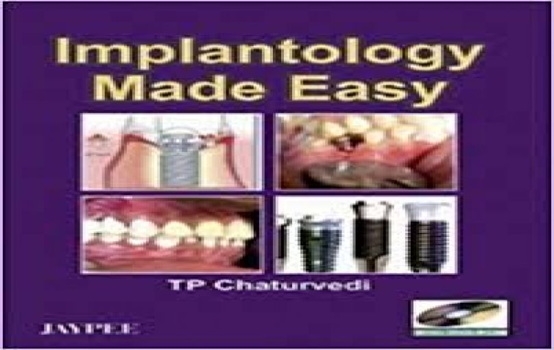 Implantology Made Easy-2008-download