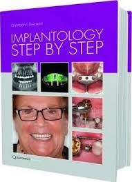 Implantology Step by Step ,2ed