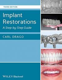 Implant Restorations- A Step-by-Step Guide -3rd Edition