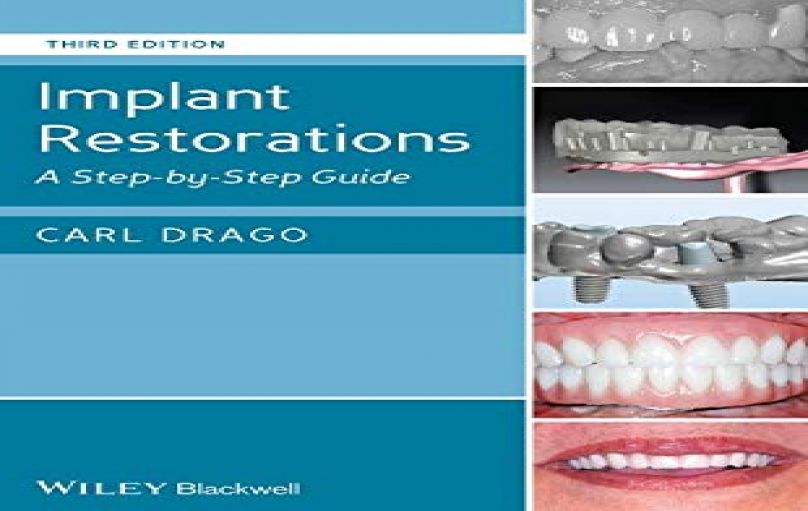 Implant Restorations- A Step-by-Step Guide -3rd Edition-download