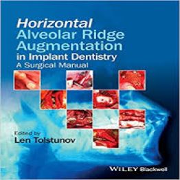 Horizontal Alveolar Ridge Augmentation in Implant Dentistry 