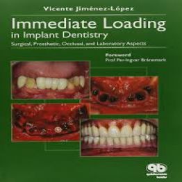 Immediate loading in implant dentistry-2005