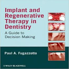 Implant and Regenerative Therapy in Dentistry-2009