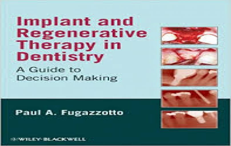 Implant and Regenerative Therapy in Dentistry-2009-download