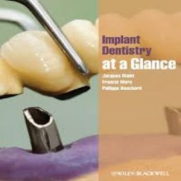 Implant Dentistry at a Glance-1st edition (2012)