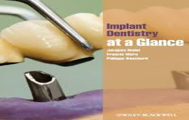 Implant Dentistry at a Glance-1st edition (2012)-download