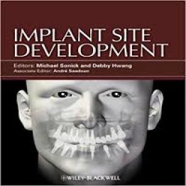 Implant Site Development-1 edition (2012)