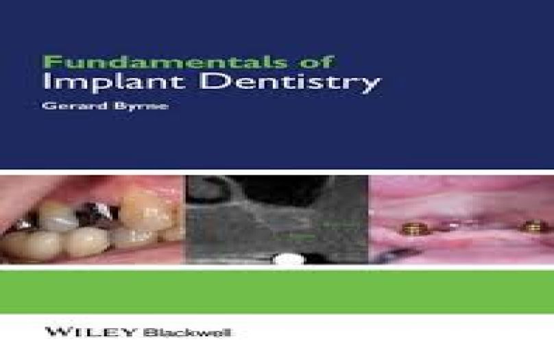 Fundamentals of Implant Dentistry-download