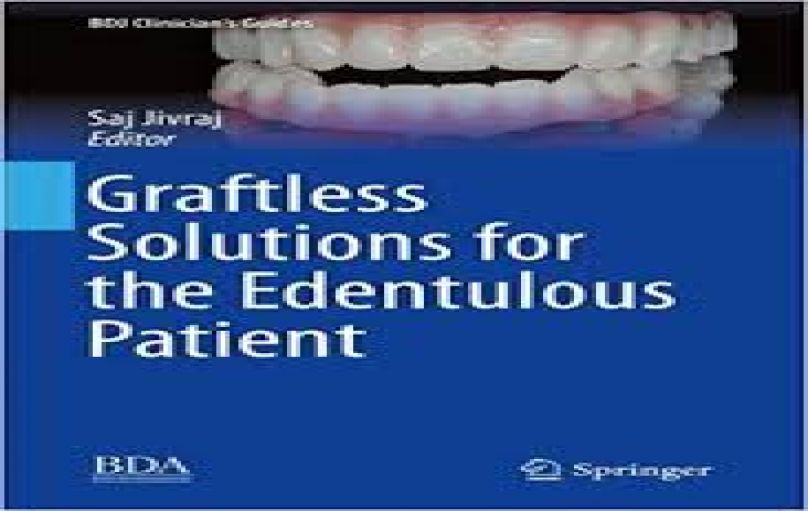 Graftless Solutions for the Edentulous Patient -download
