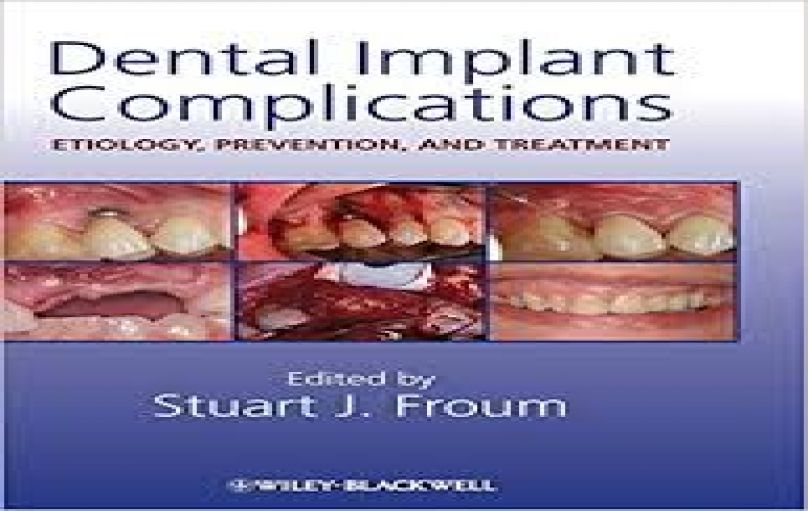 Dental Implant Complications Etiology, Prevention and Treatment-st-edition(2010)-download