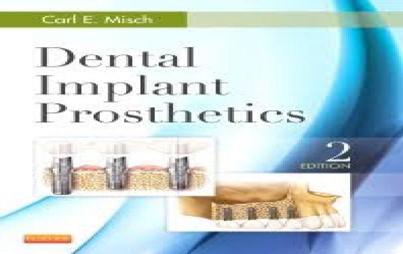 Dental Implant Prosthetics, 2ed (2015)-download