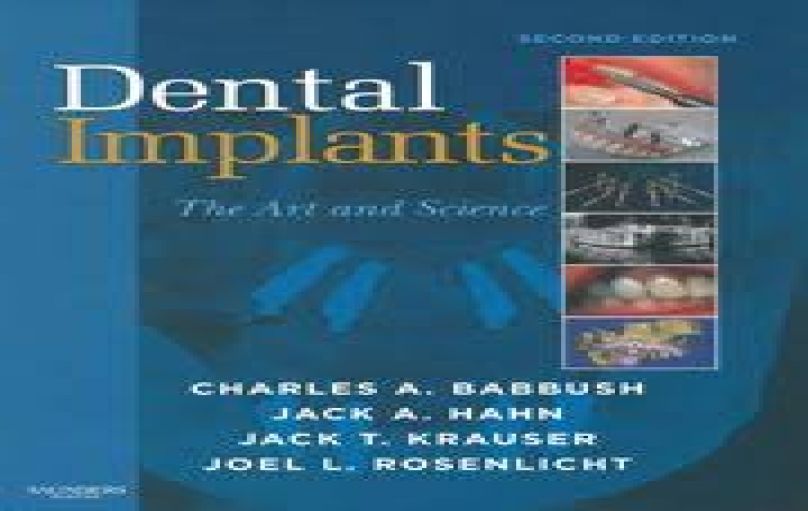 Dental Implants-The Art and Science-2nd-edition (2011)-download