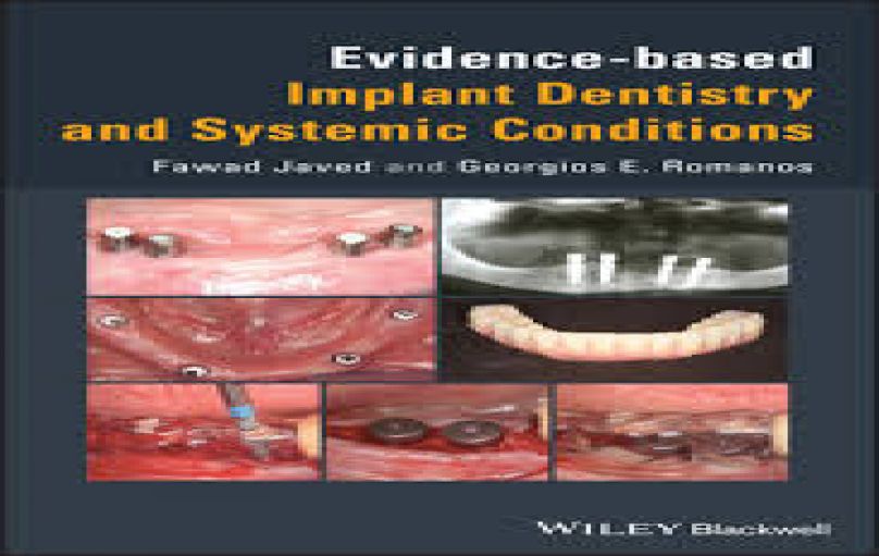 Evidence-based Implant Dentistry and Systemic Conditions-download