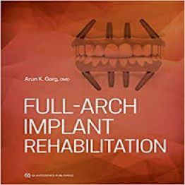 Full-Arch Implant Rehabilitation