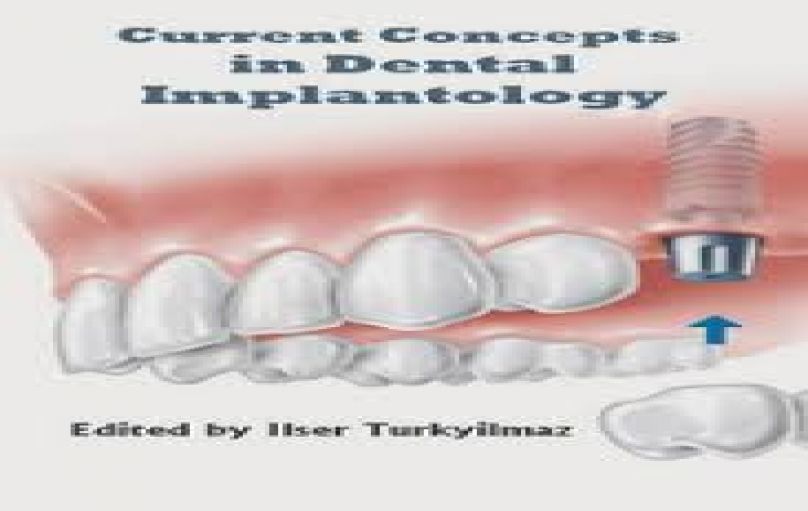 Current Concepts in Dental Implantology-download