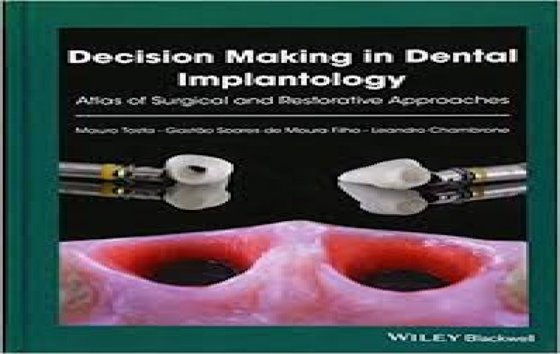 Decision Making in Dental Implantology-download