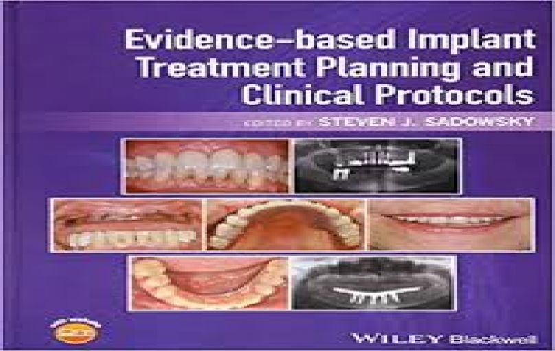 Evidence-based Implant Treatment Planning and Clinical Protocols-2017-download