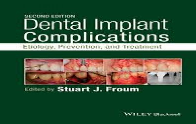 Dental Implant Complications (2nd edition-2016)-download