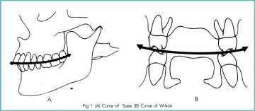 Bài 5:Hiểu biết về đường cong Spee và Wilson và ứng dụng trong thực hành chỉnh khớp.