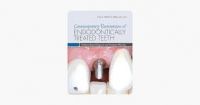 Contemporary Restoration of Endodontically Treated Teeth (2013)