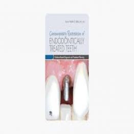 Contemporary Restoration of Endodontically Treated Teeth (2013)