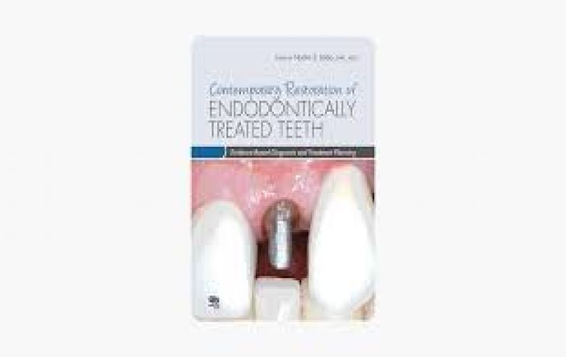 Contemporary Restoration of Endodontically Treated Teeth (2013)-download