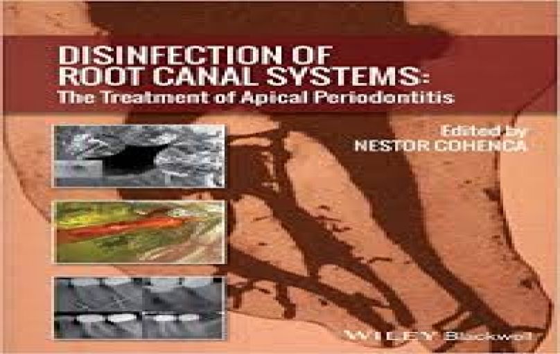 Disinfection of Root Canal Systems-download