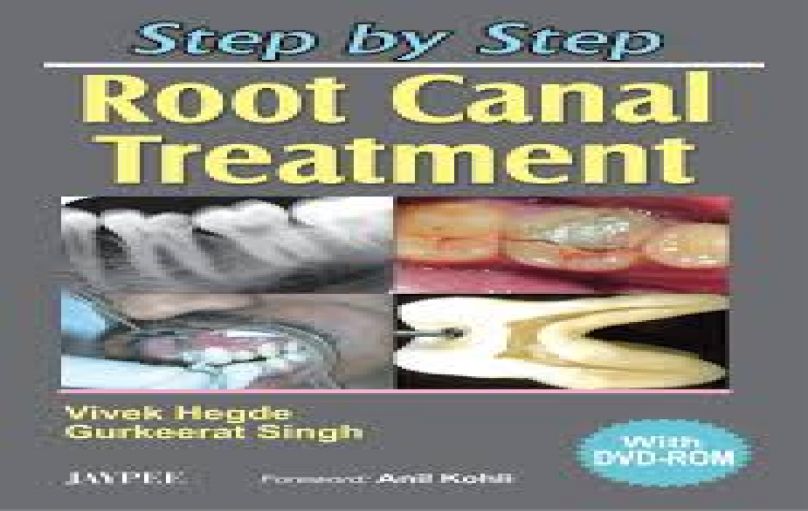 Step by Step® Root Canal Treatment (2006)-download