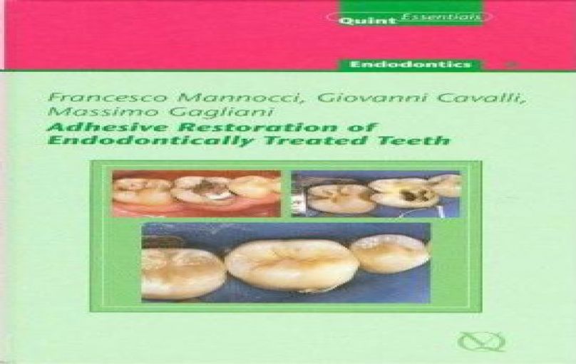 Adhesive Restoration of Endodontically Treated Teeth-download