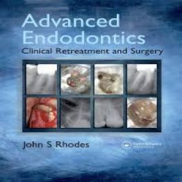 Advanced Endodontics Clinical Retreatment and Surgery